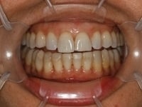 Konig Center for Cosmetic & Comprehensive Dentistry smile photos